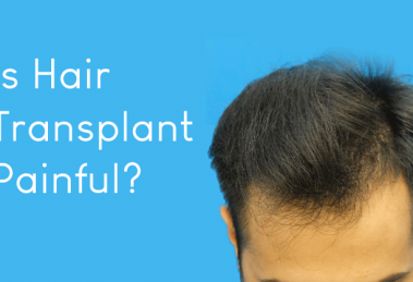 Is Hair Transplant Painful