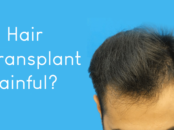 Is Hair Transplant Painful