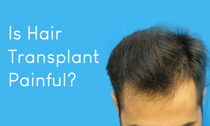 Is Hair Transplant Surgery Painful?