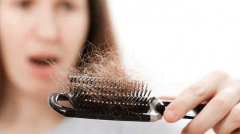 Hair Fall Problems In Women